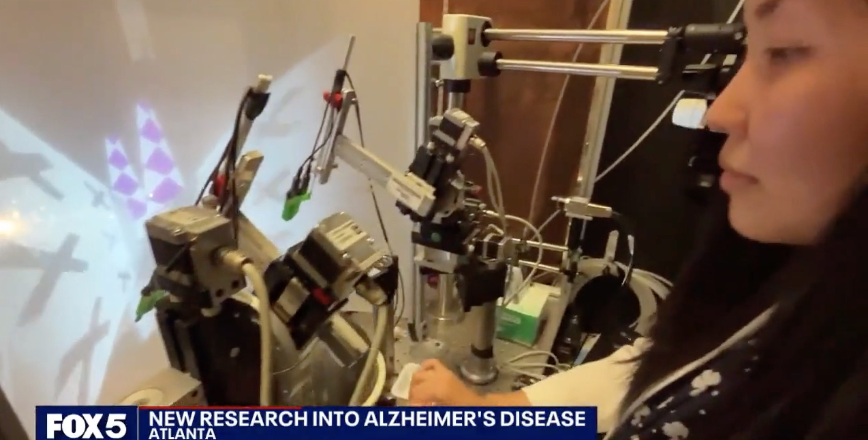 Alzheimer's