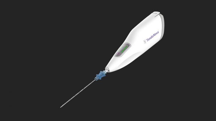 <div>
<p>TendoNova's Ocelot device, a handheld tool to perform mechanical fragmentation and debridement of targeted tissues, a common procedure for athletes and others suffering from tendon pain disorders like tennis elbow, plantar fasciitis, and jumper’s knee. (Image Courtesy: TendoNova)</p>
</div>