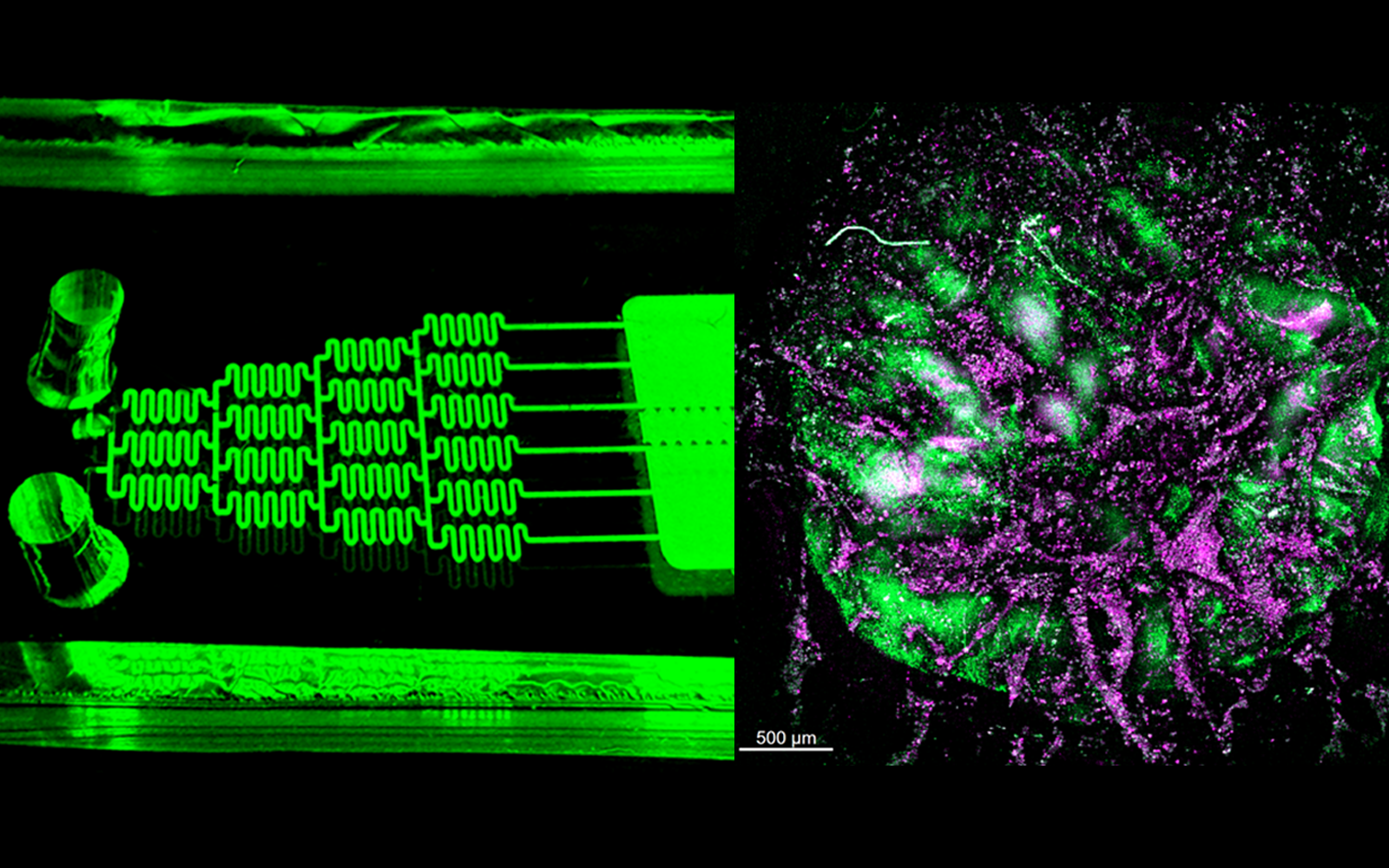 Organ-on-chip