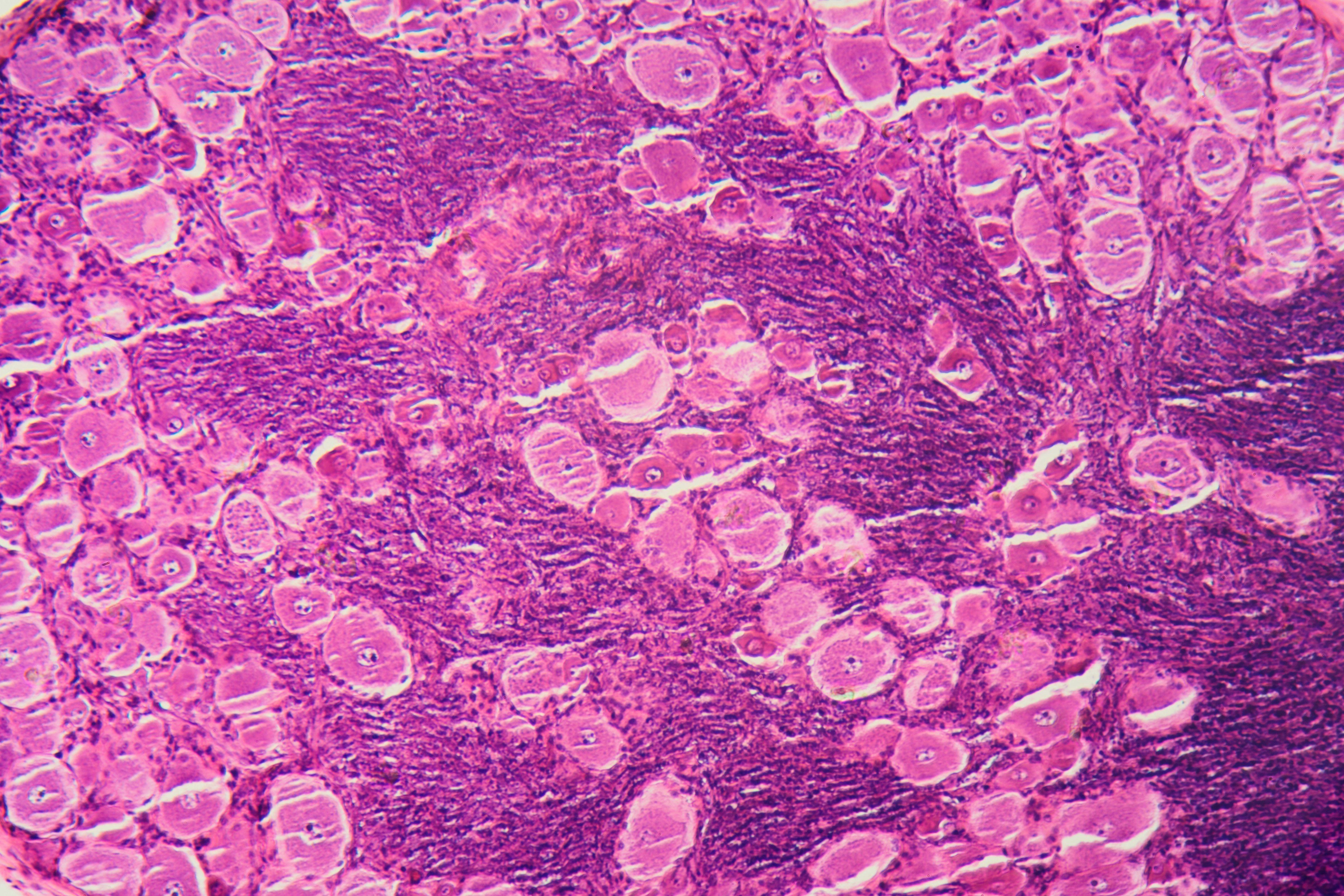 An image of pink mammalian tissue cells under a microscope