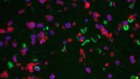 Microscope image of Salinibacter ruber