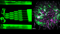Organ-on-chip