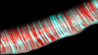 Biofilm