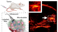 Researchers Use Air-Tagged Macrophages to Transform Cancer Imaging, Diagnosis, and Treatment