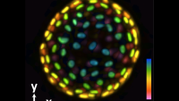 <p>An image of a colon organoid captured by a new system developed in Shu Jia’s lab that can capture dynamic, 3D information about the lab-grown cultures of tissues in a single image. The raw image was captured in 0.1 seconds. The coloration represents depths of 60 and -60 micrometers from the focal plan to depict the organoid in three dimensions. (Image Courtesy: Shu Jia &amp; Wenhao Liu)</p>