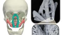 <p>The new materials could have applications for reconstructive surgery and other fields.</p>