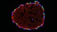 <p>This proximal tubule organoid is 30 days old, and will survive at least another 60 days. The 90-days is a record for a drop culture of any kind.</p>