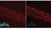 <p><em>Left: Noisy images showing neuronal structures. Right: NIDDL Deep Denoised image of neuronal structures.</em></p>